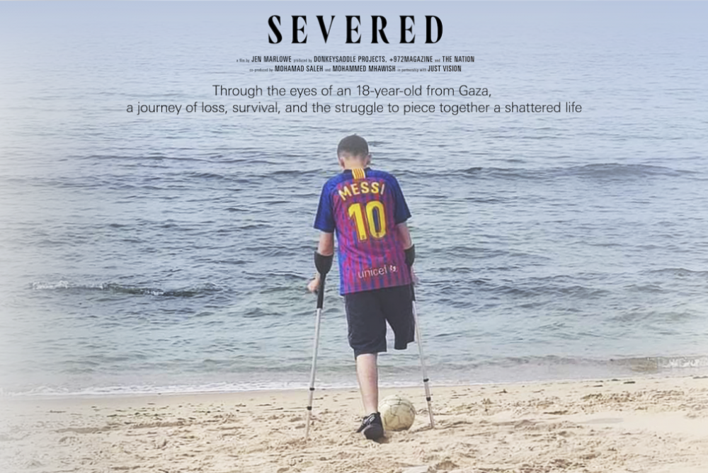 Severd Documentary